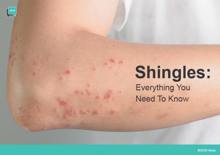 What are Shingles?
