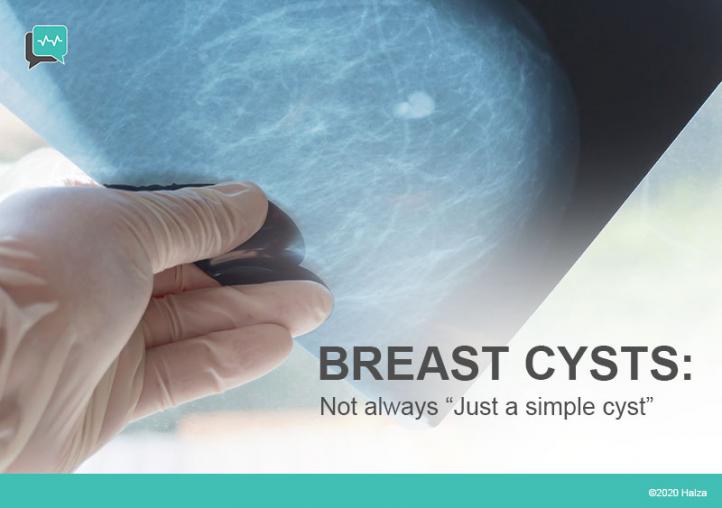 Is There More to Breast Cysts?